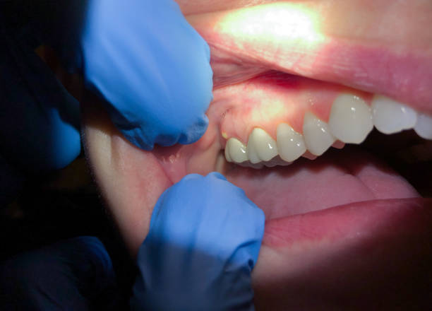 Best Root Canal Emergency Dentist  in Floris, VA