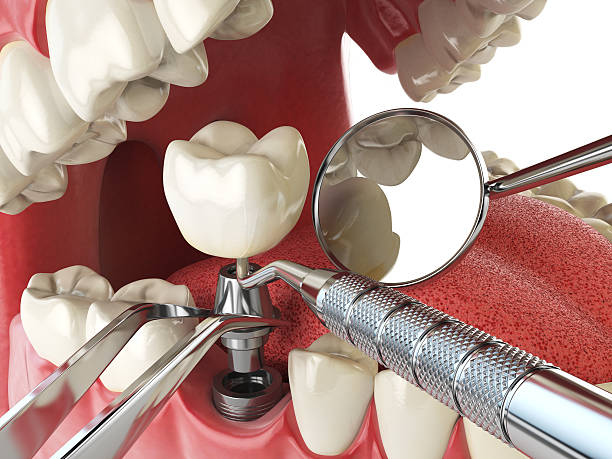 Best Tooth Infection Emergency Dentist  in Floris, VA