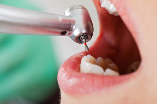 Best Affordable Emergency Dental Care  in Floris, VA